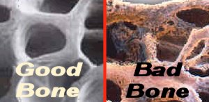 Good bones versus bad 'MILK' bones